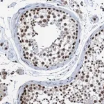 Merck Anti-CDC5L antibody produced in rabbit