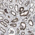 Merck Anti-KCNE3 antibody produced in rabbit