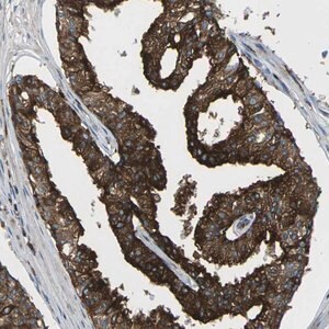 Merck Anti-SCAMP2 antibody produced in rabbit
