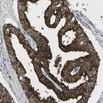 Merck Anti-SCAMP2 antibody produced in rabbit