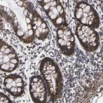Merck Anti-P2RY11 antibody produced in rabbit