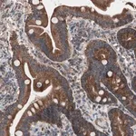 Merck Anti-CTTNBP2NL antibody produced in rabbit