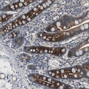 Merck Anti-ABHD15 antibody produced in rabbit
