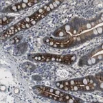 Merck Anti-ABHD15 antibody produced in rabbit