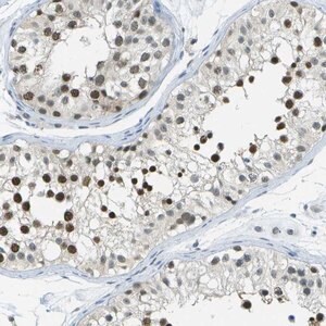 Merck Anti-NEK11 antibody produced in rabbit