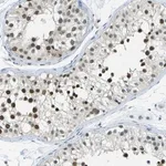Merck Anti-NEK11 antibody produced in rabbit