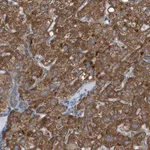 Merck Anti-C1GALT1C1 antibody produced in rabbit