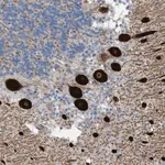 Merck Anti-ATP2A3 antibody produced in rabbit