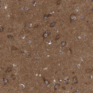 Merck Anti-ABCA10 antibody produced in rabbit
