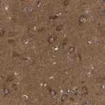 Merck Anti-ABCA10 antibody produced in rabbit