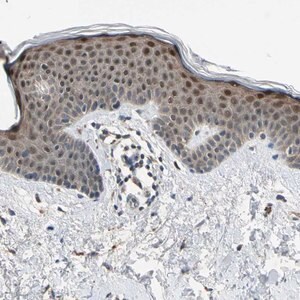 Merck Anti-RPS6KB2 antibody produced in rabbit