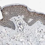 Merck Anti-RPS6KB2 antibody produced in rabbit