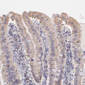 Merck Anti-RNASEL antibody produced in rabbit