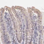 Merck Anti-RNASEL antibody produced in rabbit