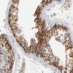 Merck Anti-ITPR3 antibody produced in rabbit