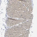 Merck Anti-TNFAIP1 antibody produced in rabbit