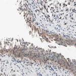 Merck Anti-RAD54B antibody produced in rabbit