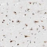 Merck Anti-RNF38 antibody produced in rabbit