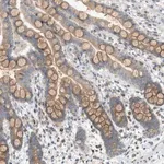 Merck Anti-DYRK1A antibody produced in rabbit
