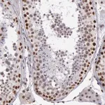 Merck Anti-NBN antibody produced in rabbit