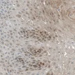 Merck Anti-SERPINB2 antibody produced in rabbit