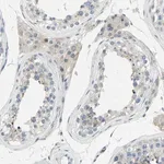 Merck Anti-ZNF184 antibody produced in rabbit