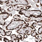 Merck Anti-IGF2BP3 antibody produced in rabbit