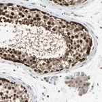 Merck Anti-HSPA4 antibody produced in rabbit