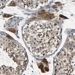 Merck Anti-FNDC3A antibody produced in rabbit