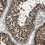Merck Anti-ANKIB1 antibody produced in rabbit