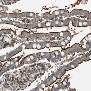Merck Anti-GPR161 antibody produced in rabbit