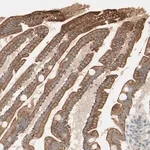 Merck Anti-MTM1 antibody produced in rabbit