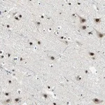 Merck Anti-MTA1 antibody produced in rabbit