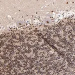 Merck Anti-NCOR2 antibody produced in rabbit