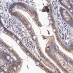 Merck Anti-SYAP1 antibody produced in rabbit
