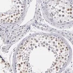 Merck Anti-TEX11 antibody produced in rabbit
