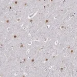 Merck Anti-NKAP antibody produced in rabbit