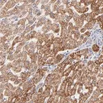 Merck Anti-TIMM8A antibody produced in rabbit