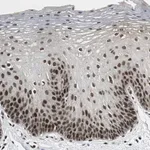 Merck Anti-CDK9 antibody produced in rabbit