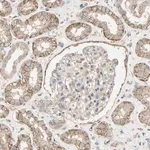 Merck Anti-CDH6 antibody produced in rabbit