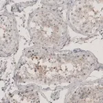 Merck Anti-CT83 antibody produced in rabbit