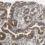 Merck Anti-HDHD5 antibody produced in rabbit