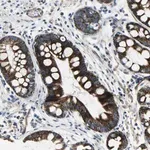 Merck Anti-CHI3L2 antibody produced in rabbit