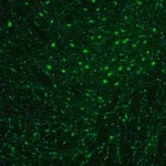 Merck Anti-OGFOD1 antibody produced in rabbit