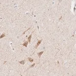 Merck Anti-CLCN5 antibody produced in rabbit