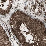 Merck Anti-COPS5 antibody produced in rabbit