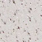 Merck Anti-CPN2 antibody produced in rabbit