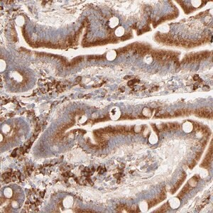 Merck Anti-PARP12 antibody produced in rabbit