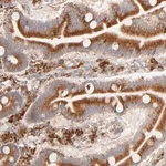 Merck Anti-PARP12 antibody produced in rabbit