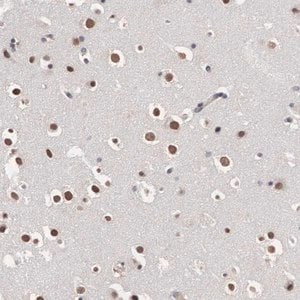 Merck Anti-OTX2 antibody produced in rabbit